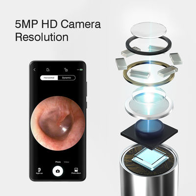 3.9mm HD 디지털 와이파이 귀 오토스코프 인공지능 방향 기능과 와이파이 연결